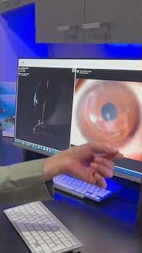 Keratoconus Corrections and Modern Treatments @GulaniVision