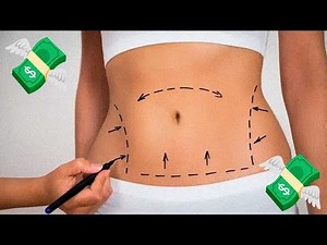 Quanto custa fazer uma ABDOMINOPLASTIA?