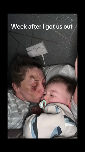 One Year of Recovery from Domestic Abuse