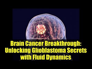 Brain Cancer Breakthrough: Unlocking Glioblastoma Secrets with Fluid Dynamics