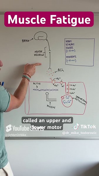 What is muscle fatigue?