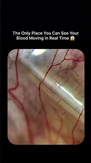 Real-Time Blood Flow in the Human Eye | Sclera Blood Vessels Explained 🔬