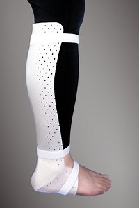 [Hot Item] Pre-Cut Thermoplastic Splint for Orthopedic Physiotherapy Rehabilitation Fracture Fixation