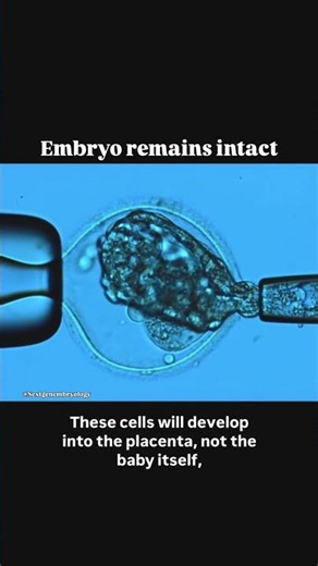 Is Embryo Biopsy Worth It?