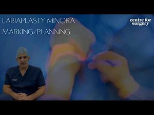Labiaplasty Surgery Planning + Marking by Dr Metin Nizamoglu | CFS | London UK