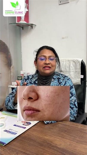 Are Chemical Peels Harmful? | Skincare Myth Explained