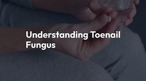 UnderstandingToenailFungusCauses