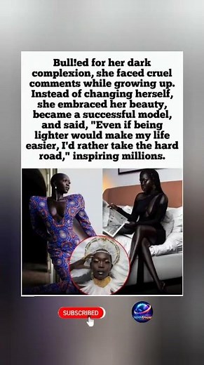 From Refugee Camps to Supermodel: The Queen of the Dark's Incredible Story #fyp #ytshorts # #shortyz