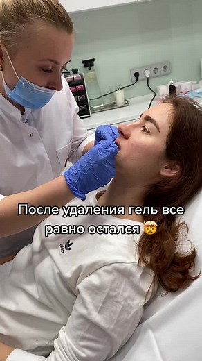 Lip Augmentation Procedure Explained in Detail