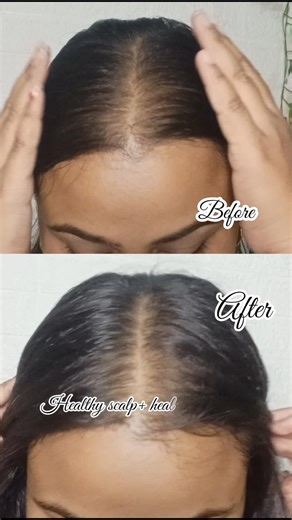 Elevate your scalp care routine with Biolage Scalp Sync Purifying Concentrate ‪@Biolage‬ #biolage