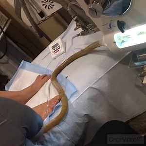 25K views · 312 reactions | Colon Cleanse SALE 99! It's time for a...