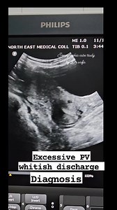 #sonographiccasestudy #reelsvideo #reelsvideoシ #education #ultrasound #Radiology #fblifestyle | Sonographic case study