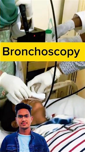 Bronchoscopy procedure#Bronchoscopy #shortsfeed #shorts #hospital #RespiratoryCare #Endoscopy #viral