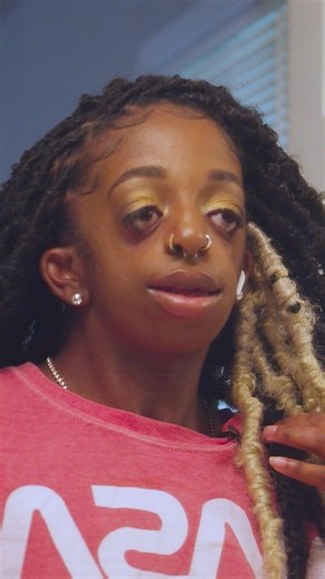 9.1K views · 230 reactions | Modelling is how I express self-love ✨ #fbreels #shakemybeauty #treachercollins #treachercollinssyndrome #selflove #modelling | Shake My Beauty | Facebook