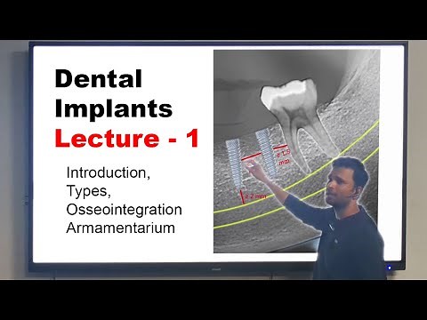 Dental Implants for Beginners - 1 | Introduction, Types, Osseointegration & Armamentarium Explained