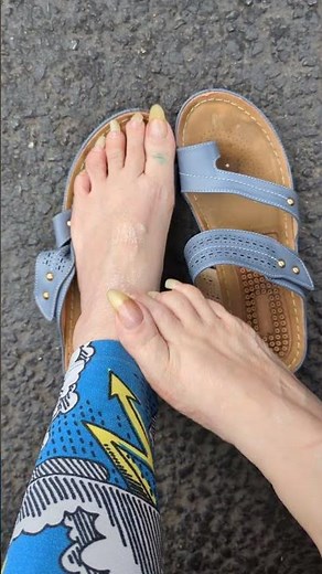 long toenails natural/ sometimes scratching an itch,causes damage.