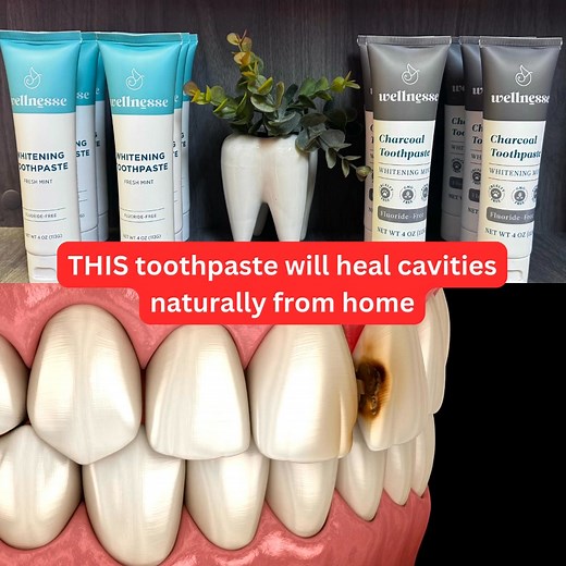 176 reactions · 29 shares | Tired of painful drilling and fillings?...