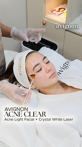 18K views · 11K reactions | Struggling with acne and stubborn scars?...