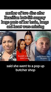 1.2M views · 31K reactions | mother of two dies after Brazilian butt-lift surgery large parts of her brain, lungs and heart were missing #ericjaystreetnews | Eric Johnson | Facebook