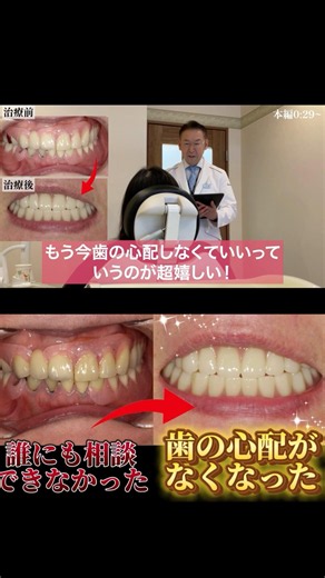 A woman in her 60s who wanted to "chew properly!"... how she went from full dentures to "forgetti...