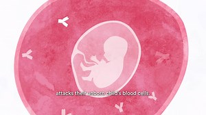 8.2K views · 257 reactions | Autoantibody diseases impact more than 240 million people worldwide. See how J&J researchers are working to help patients that have abnormal immune responses to viruses. | Johnson & Johnson | Facebook