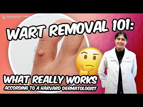 Wart Removal 101: What Really Works According to a Harvard Dermatologist