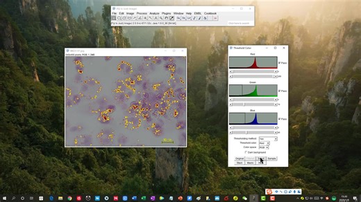 油红O染色测量分析