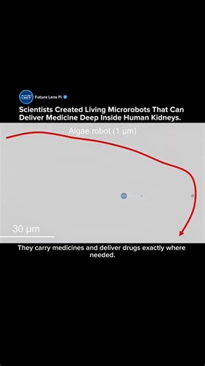 Scientists Create Living Microrobots That Can Deliver Medicine Deep Inside the Kidney #medical #tech
