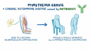 Video: Myasthenia gravis: Nursing - Video Explanation! | Osmosis | Osmosis