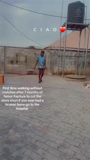 First Steps After Femur Fracture Recovery