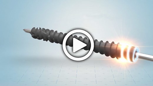 Acutrak 2 Headless Compression Screw System Overview