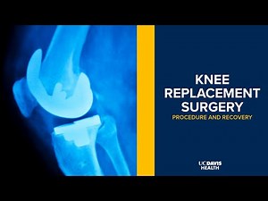 Knee Replacement Surgery Explained | UC Davis Health