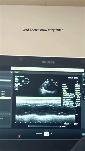 Cath lab technician echocardiography