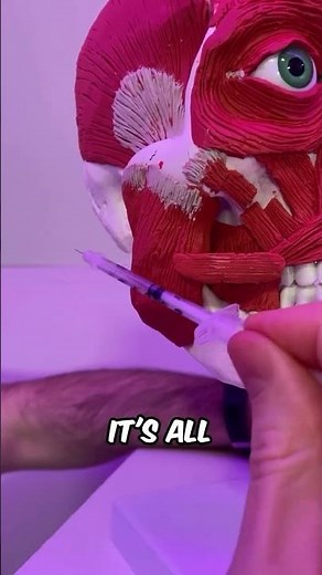 Here’s how to avoid hitting the Risorius when treating the masseter muscle. #botox #aesthetics