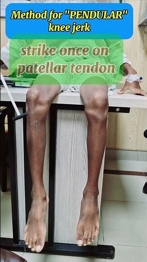 Pendular knee jerk examination method - neurology Examination - cerebellar signs examination