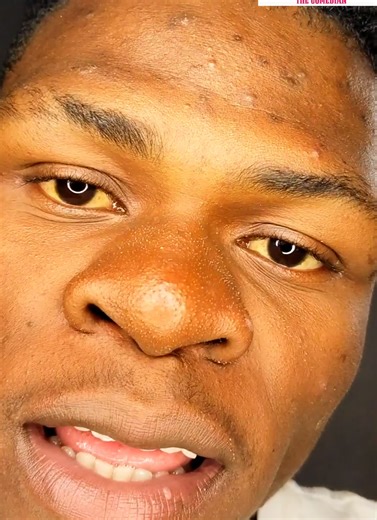 Ravs Pro: Tendando Liposa and Comedy Skits