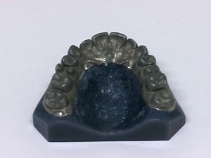 Accuracy in Dental Medicine, A New Way to Measure Trueness and Precision