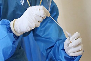 Scientists discover an innovative technique for treating cancer