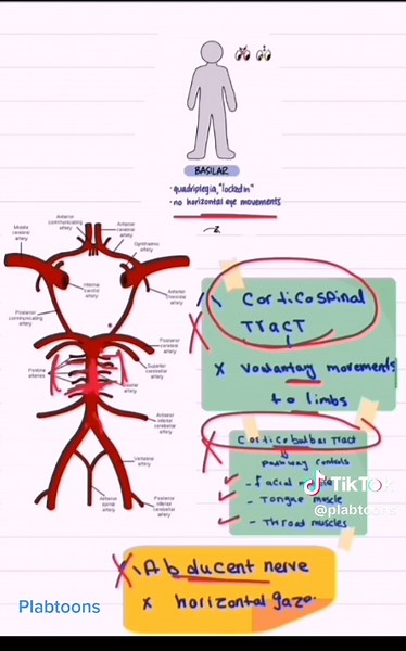 Localizing the Vascular Origin of Stroke for Medical Students