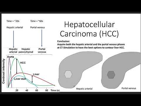 Liver SBRT IV contrast phases explained