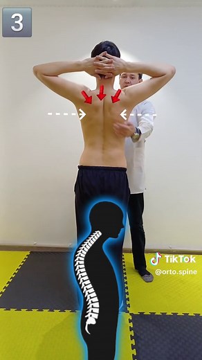 🎯 Correction Kyphosis.💯 Best Exercises #ortospine,#ortopedutebaev, #kyphosis,#lordosis,#scoliosis,