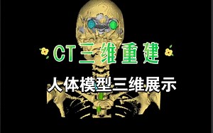 CT三维重建,三维可视化,3D软件开发 Python PyQt VTK