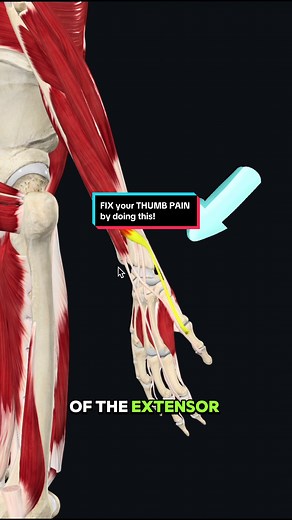 Understanding De Quervain's Tenosynovitis and Treatment