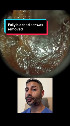 Effective Ear Wax Removal with WAXscope®