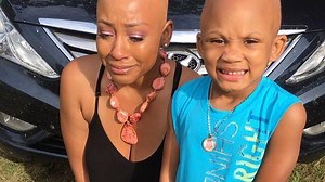 This singer with alopecia inspired a young fan to embrace her alopecia too