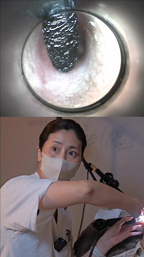 Japanese Professional Deep Ear Cleaning for Relaxing ASMR Experience
