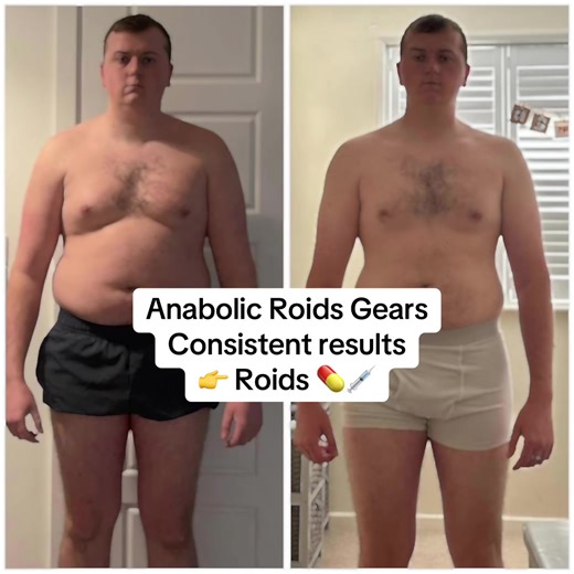 Anabolic Roids Gears Consistent results 👉 Roids 💊💉 . . . #musclegain #fatburner #weightloss #fat #bodybuilding