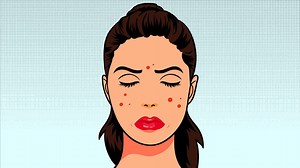 32K views · 226 reactions | WATCH: The Reason Behind Your Pesky Acne. Why You Have It and How To Treat It. #PimplesNoMore | AcneCare | Facebook