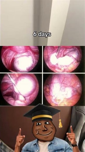 There’s a Cyst Inside Her 😳 Why It Has to Be Removed