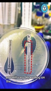 4.7K views · 72 reactions | How to Interpret E-Test❓ YouTube channel:https://www.youtube.com/@MEDLAB_Scientist #MLT #ASCP #MLS #highlights2025 #highlightseveryone #everyoneシ゚ #fypシ゚viralシ #followerseveryone #reelsfbシ #highlightsシ゚ #shorts #trend #trendingnow #everyonefollowers #trendingvideo #short #reelsfypシ #reelschallenge #reelsvideoシ | Medical Laboratory Scientists | Facebook